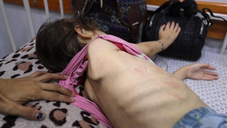 Tragedi Gaza: Bayi Tak Berdaya Menangis Karena Kelaparan