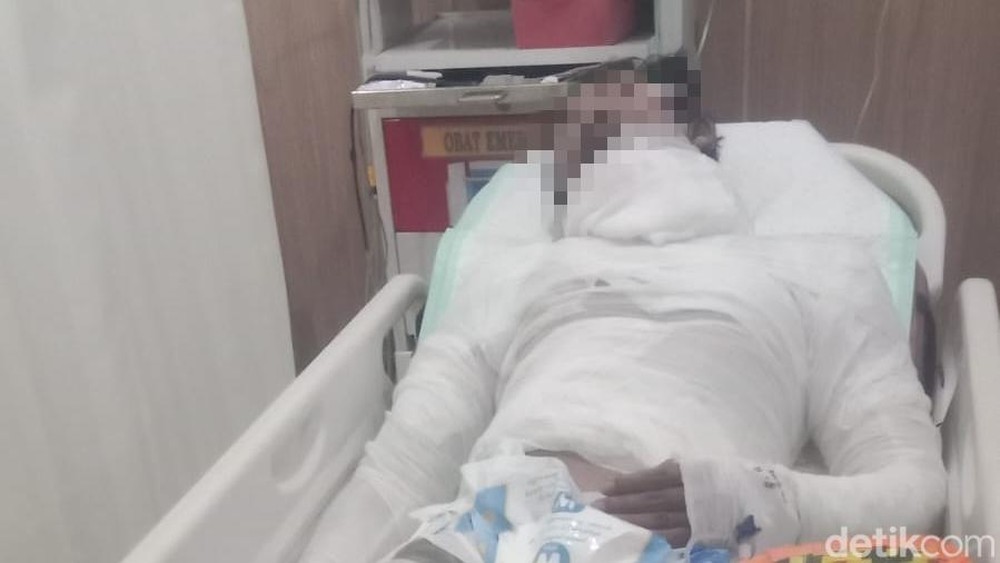 Sopir Dibakar Bos di Bali Kondisi Kritis Keluarga Tercekik Biaya